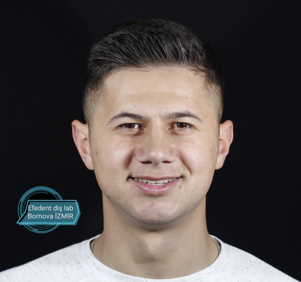 özel efedent diş protez laboratuvar hiz.ltd.şti.