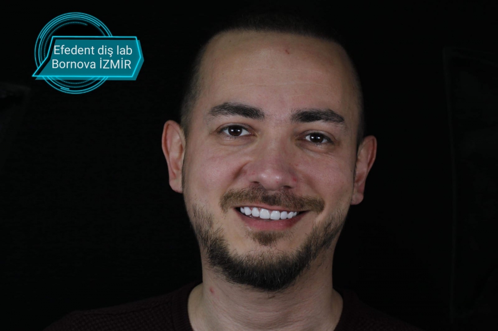 izmirde en iyi zirkonyum diş